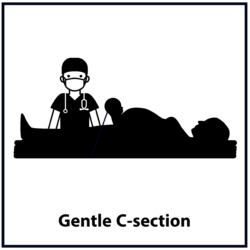 Gentle C-section