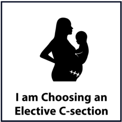 I am choosing an elective c-section