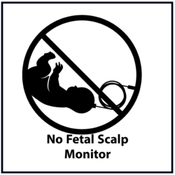 No fetal scalp monitor (black)