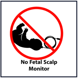 No fetal scalp monitor (red)