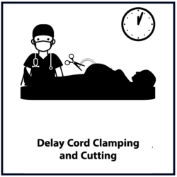 Delayed Cord Clamping and Cutting