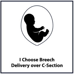 I choose breech delivery over c-section